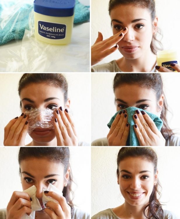 siyah-noktalara-çözüm-2